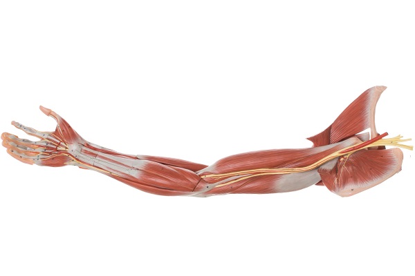 Plexus brachialis är armens nervfläta